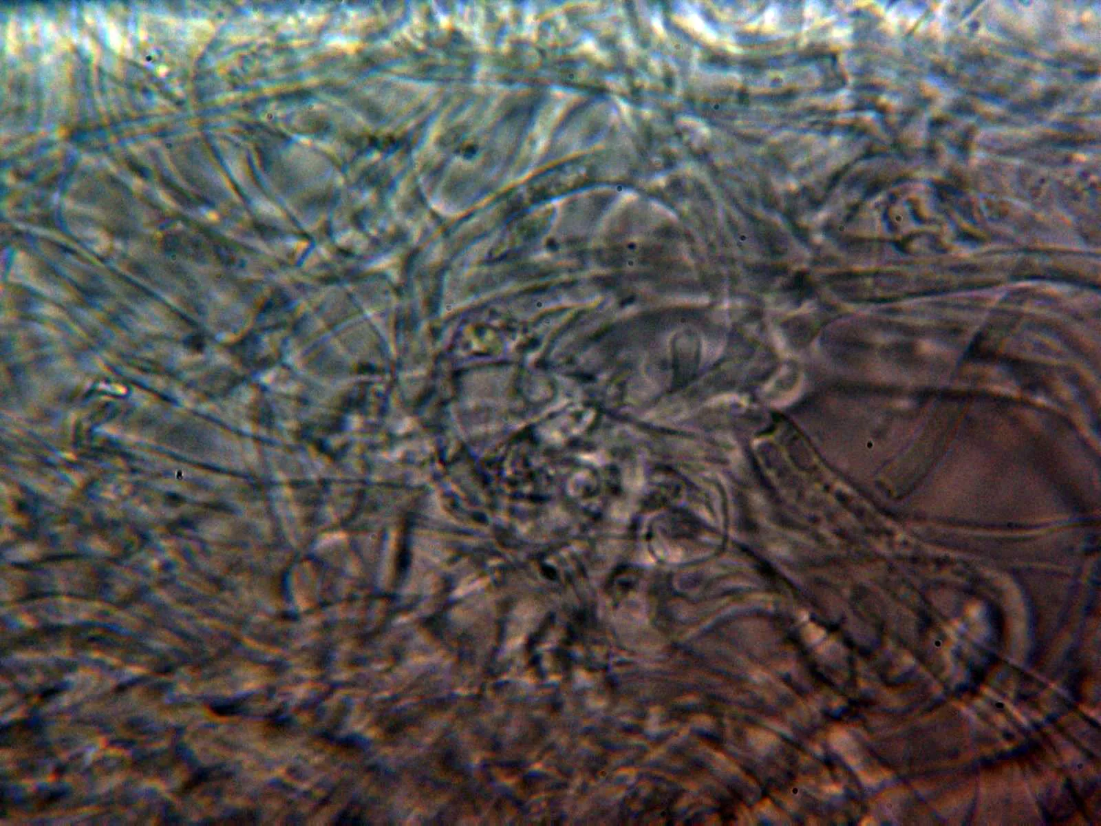 Microscopía de Russula xerampelina - 10 - Hifas cutícula agua